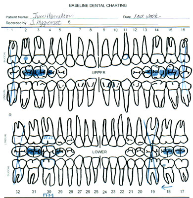dental chart with restorations